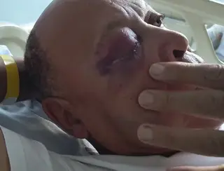 Idoso é agredido com socos no rosto após se envolver em acidente de trânsito na Zona Leste de SP; motorista fugiu do local