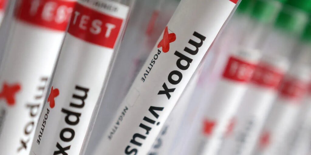 Brasil Atinge 140 Casos Confirmados de Mpox em 2026, Sem Óbitos, Aponta Ministério da Saúde